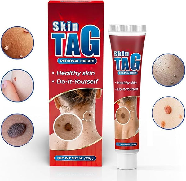 Skin Tag Remover Cream ( BUY 1 GET 1 FREE )