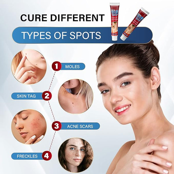 Skin Tag Remover Cream ( BUY 1 GET 1 FREE )