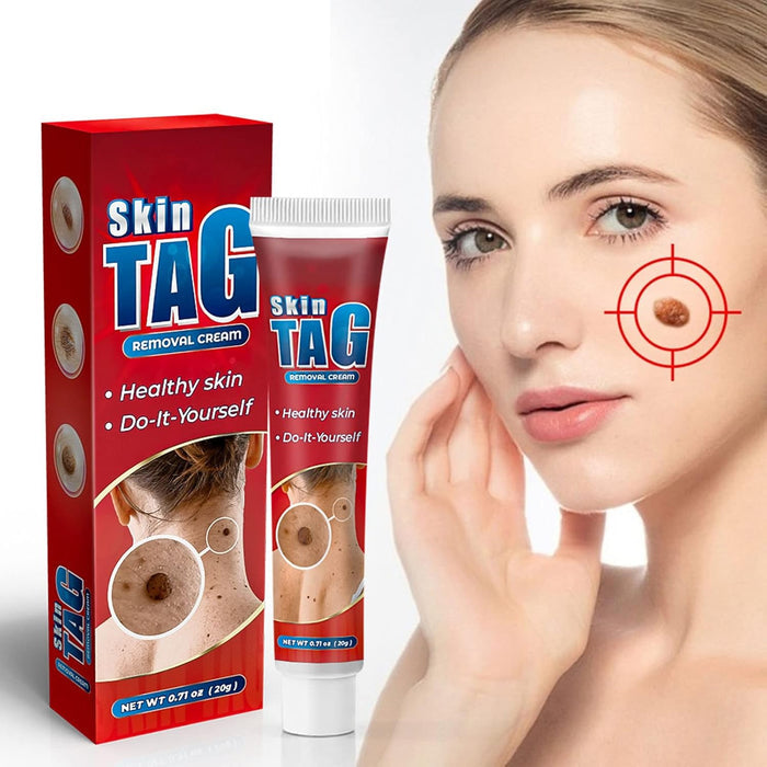 Skin Tag Remover Cream ( BUY 1 GET 1 FREE )
