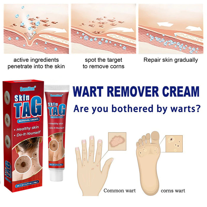 Skin Tag Remover Cream ( BUY 1 GET 1 FREE )