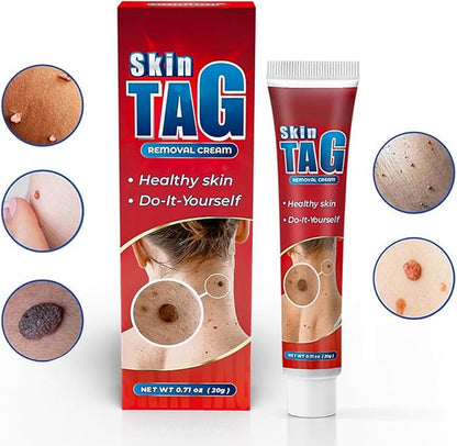 Skin Tag Remover Cream ( BUY 1 GET 1 FREE )