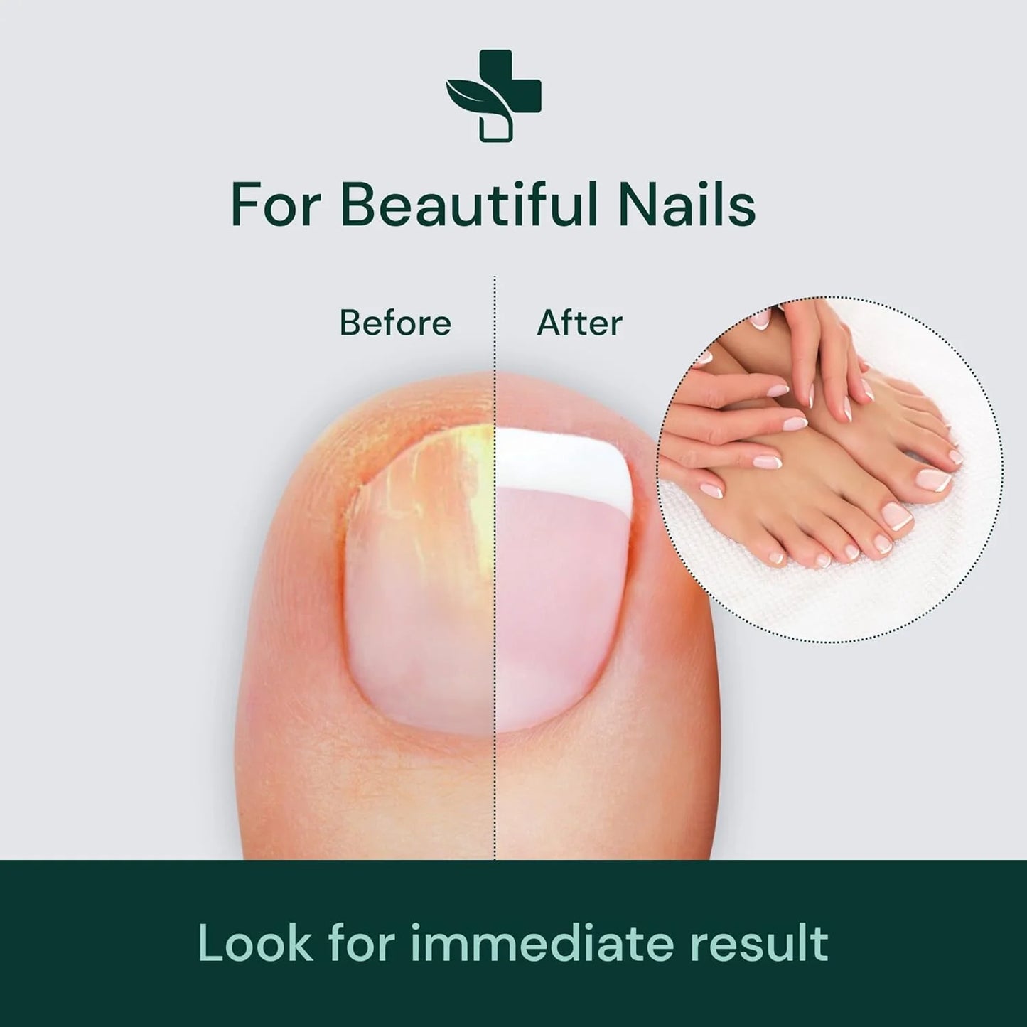 Nail Repair Serum Buy 1 Get 1 Free